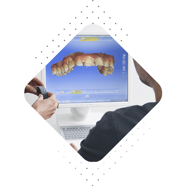 empastes reconstrucciones dentales